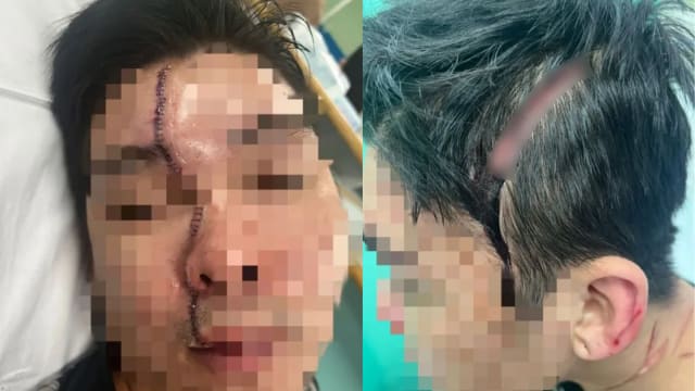 邻居纠纷变严重砍人案 马国男子缝120针毁容