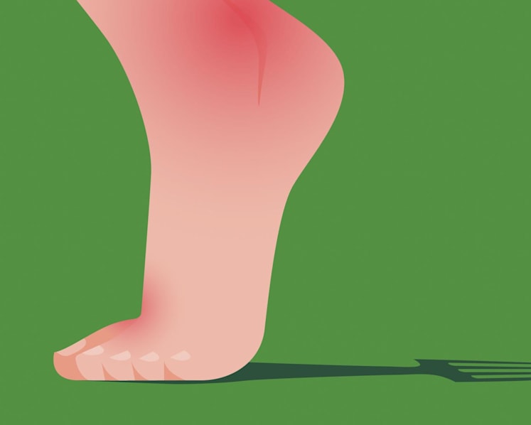 What exactly is gout – and why are more people getting it?