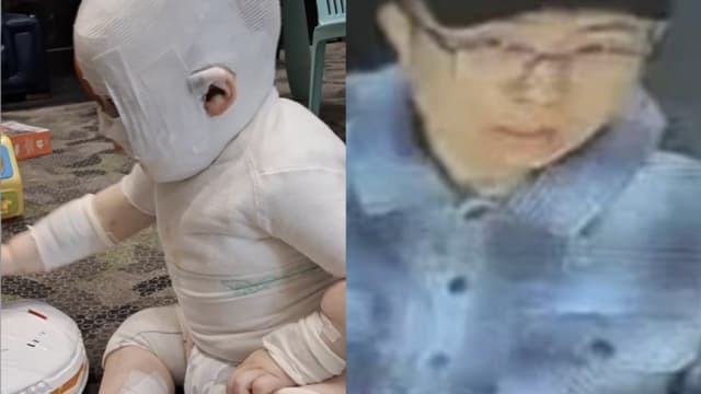对澳洲男婴泼热咖啡致严重烫伤 中国留学生被通缉