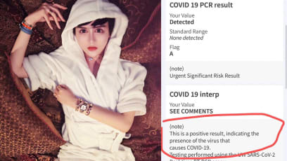 Chinese Influencer ‘Snake Spirit Boy’ Contracts COVID-19 While In The US; Says He’s “Disfigured”