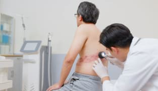 Some Singapore doctors see more patients with shingles over past 2 years