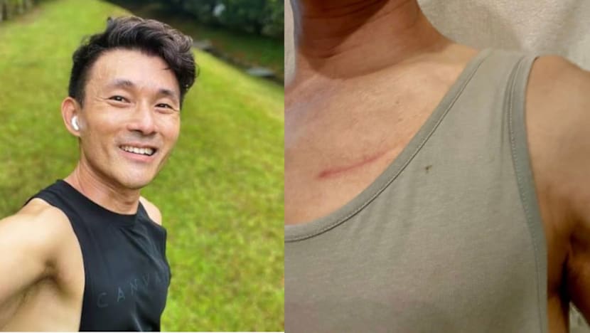 MP Baey Yam Keng Hit By Cyclist Riding Against Traffic Flow During His Morning Run