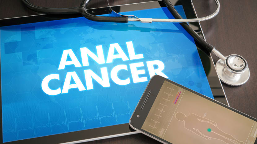 Anal cancer risk increases due to greater exposure to virus linked to cervical cancer, multiple sex partners