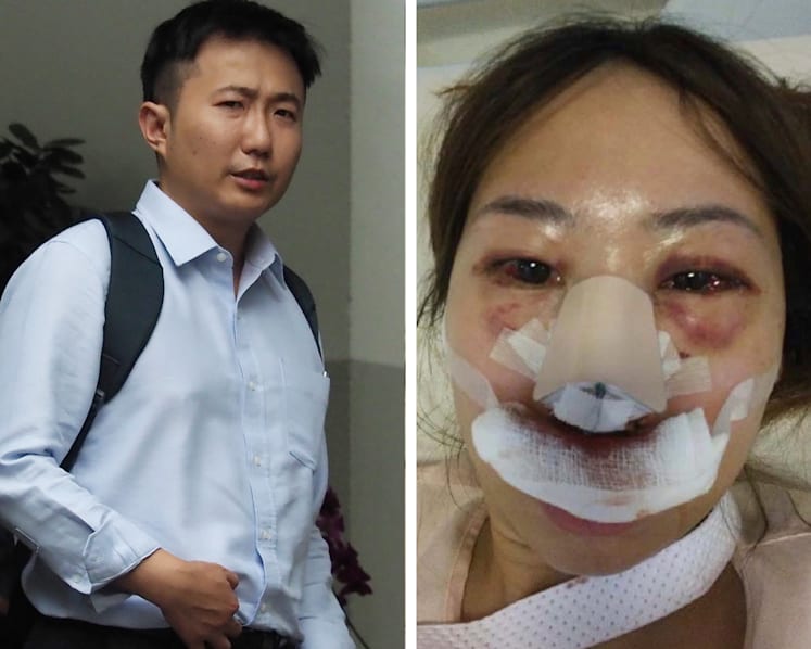 Accused of bashing girlfriend, doctor claims his alcoholism causes blackouts and he doesn’t recall assault