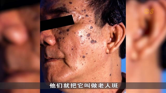 狮城有约 | 皮肤老化该如何护理？