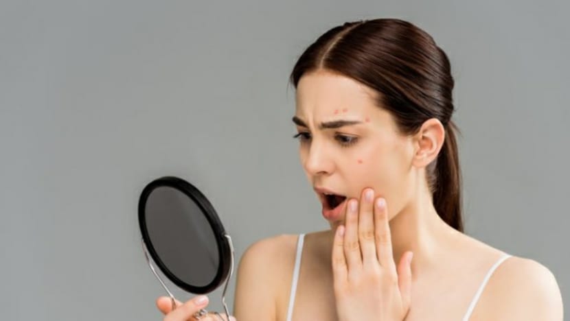 Related article image