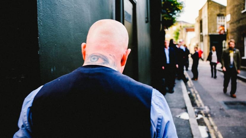 What causes balding? What causes balding?