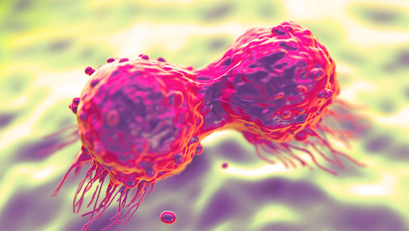 Mobile virus test could help cut cervical cancer-linked deaths