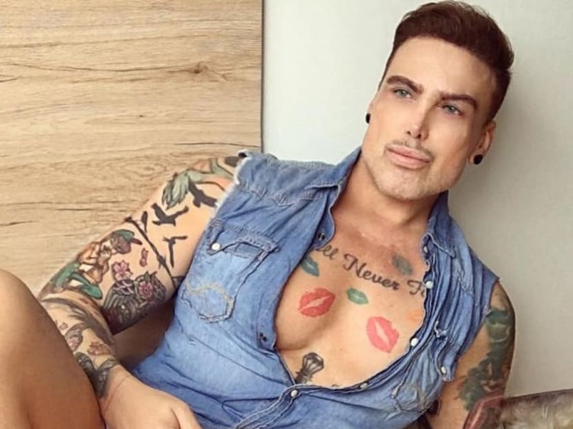 Mr Ciganovic had to endure three surgeries to correct the condition known as priapism which occurred after his 2017 nose job in Iran. Mr Ciganovic had to endure three surgeries to correct the condition known as priapism which occurred after his 2017 nose job in Iran.