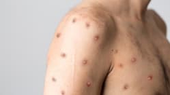 Related article image