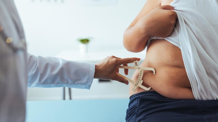 Commentary: I jogged 15km a week, so why did I keep getting fatter? Commentary: I jogged 15km a week, so why did I keep getting fatter?