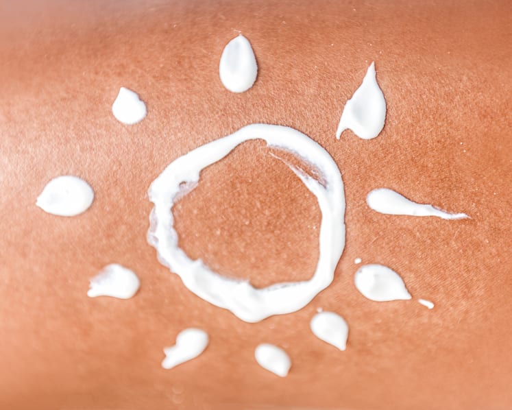 Skin cancer doesn’t just hit those with fair skin; young adults with constant sun exposure at risk