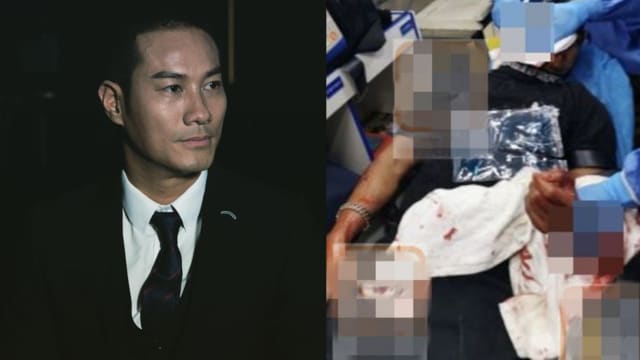 无缘无故被人砍3刀　黄竣锋请求有关当局还他公道