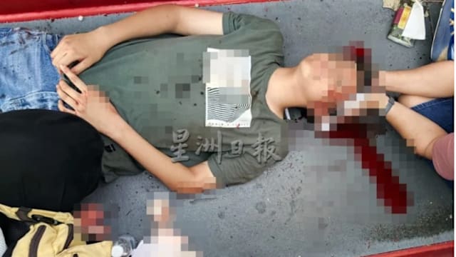 在槟城游乐场玩旋转滑梯 马国少年撞破头血流不止