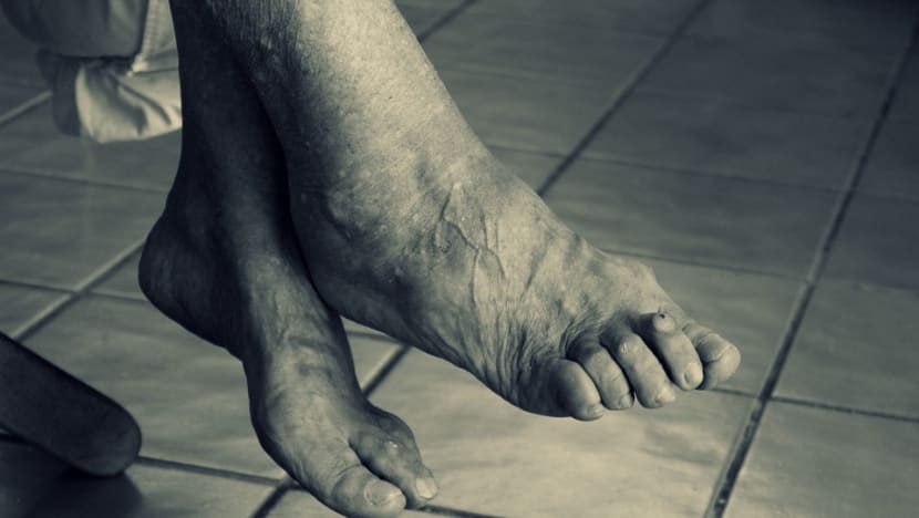 Court orders man to leave home, stop 'tormenting' 90-year-old mother with dementia; cites impact of caregiver stress