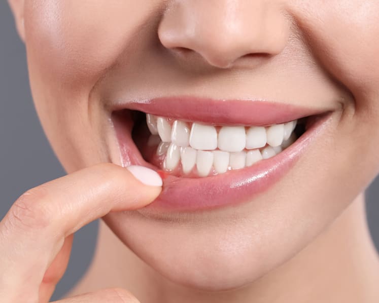 Does rubbing salt on mouth ulcers work? What you need to know about treating canker sores