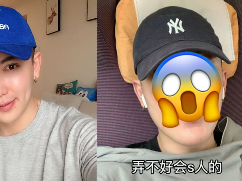 This Douyin Star Says He &ldquo;Aged 20 Years&rdquo; & Became An &ldquo;Ugly Monster&rdquo; After Botched Plastic Surgery