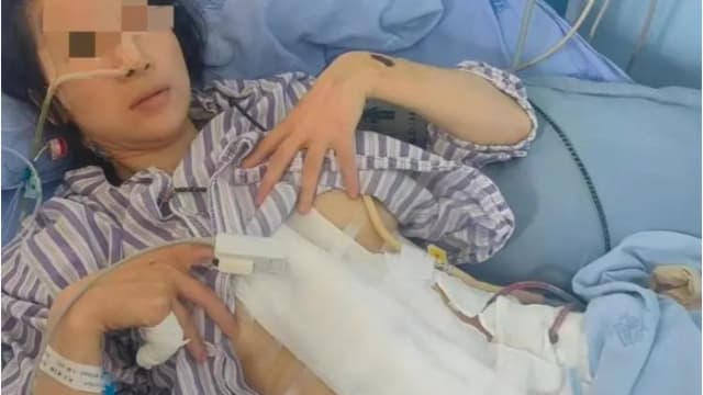 中国女子称两年遭家暴16次 内脏受损恐终身挂粪袋