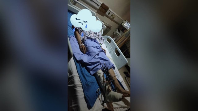 摩托车骑士遇车祸身体多处骨折 家人寻目击者助查