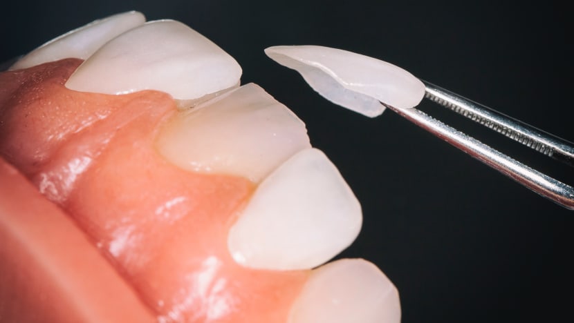 Up to 72 National Dental Centre patients treated with partially sterilised instruments