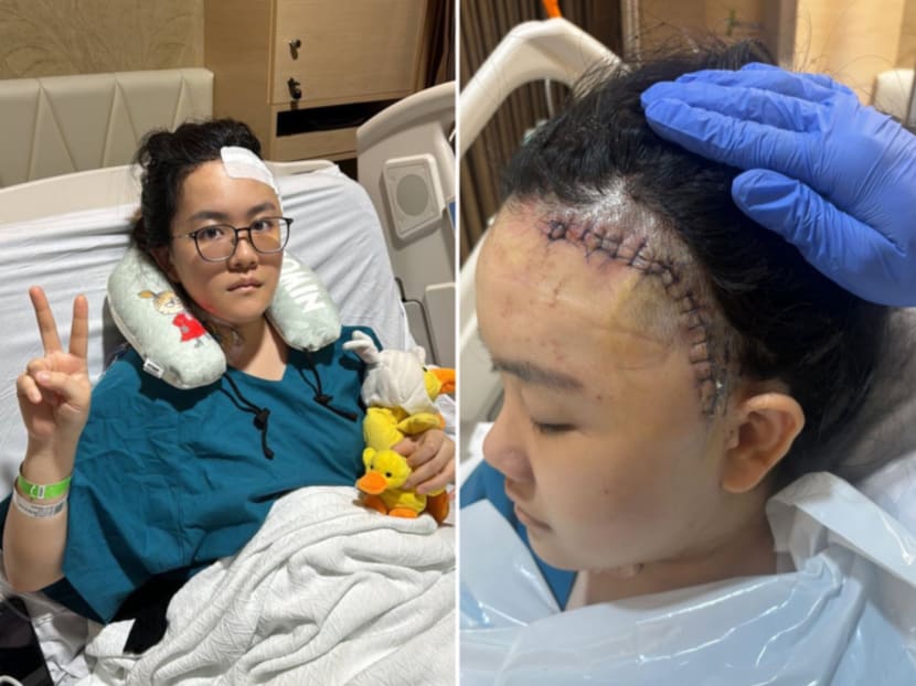 After scans confirmed that Ms Tan Cheng Hui (pictured) had a ruptured brain aneurysm, the 26-year-old underwent emergency brain surgery and survived.