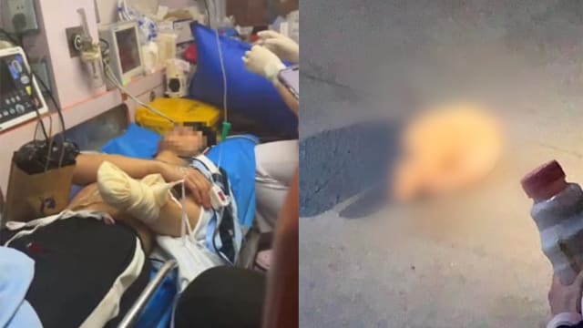 直播一半遭砍！中国网红手掌疑被砍飞