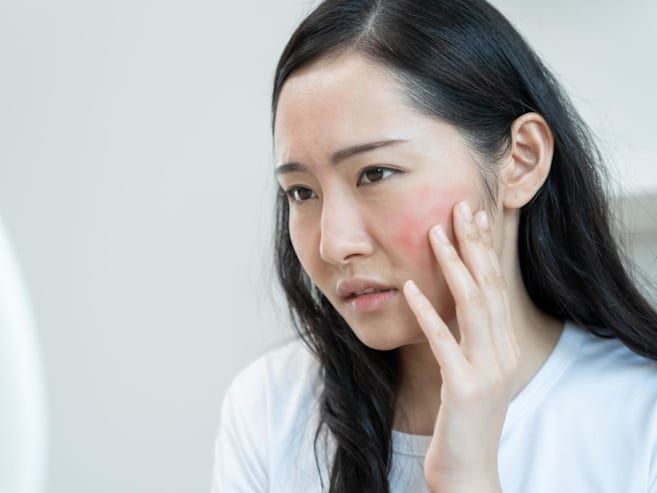 My face gets flushed and red more often – could it be rosacea, and why does it get worse with age?