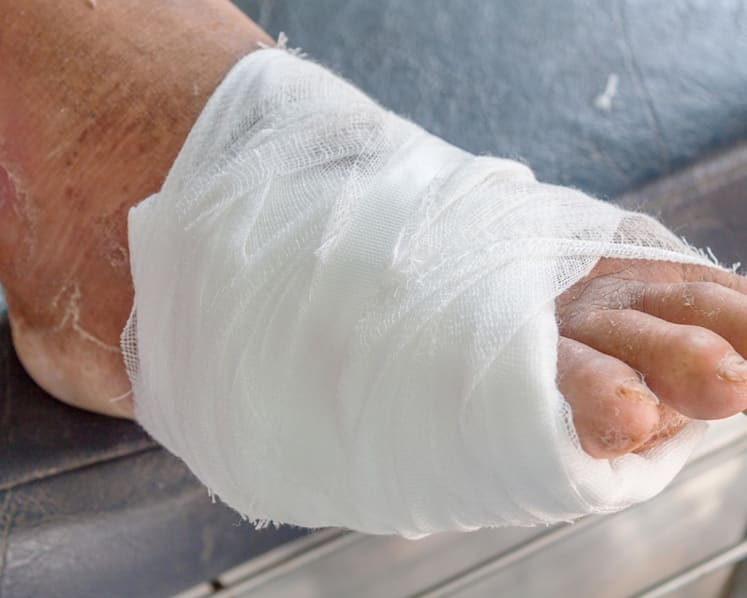 Doctor suspended after diabetic patient with infected foot had leg amputated