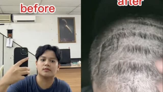 马国女烫卷发不成  演变成断发和脱发被迫剃光头