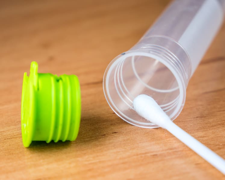 DIY home kits: How useful are they for screening HIV, STIs and cervical cancer