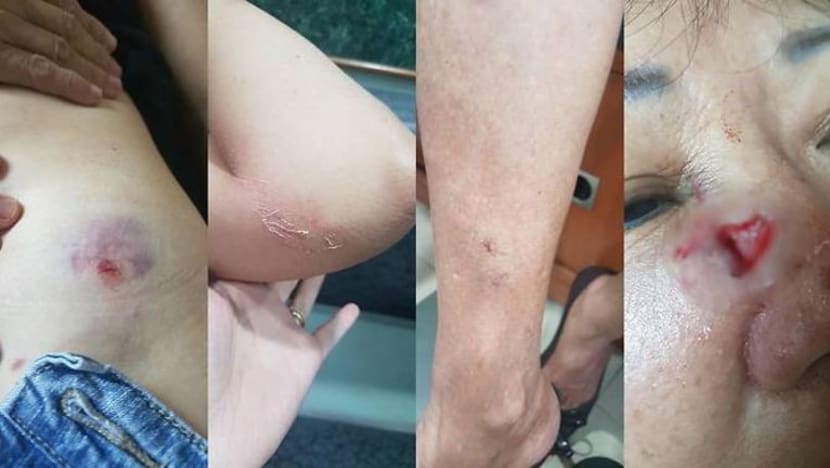 Warga tua 65 tahun dilanggar e-skuter, penunggang larikan diri Warga tua 65 tahun dilanggar e-skuter, penunggang larikan diri