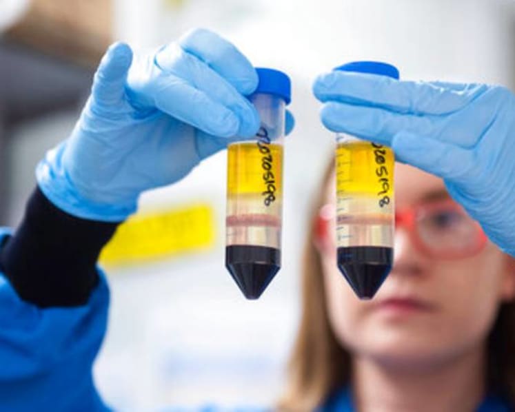 AstraZeneca manufacturing error clouds COVID-19 vaccine study results