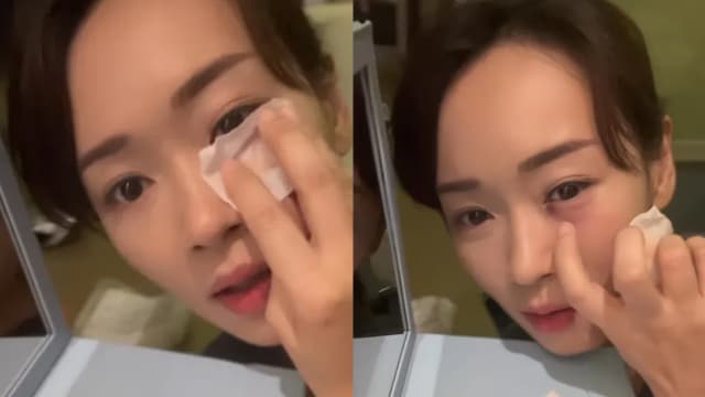 杨思琦拍戏遇意外　被道具枪戳中眼部！