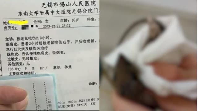 中国女子被老鼠咬 一怒之下竟反咬老鼠一口