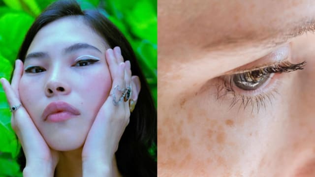 3种天然黑斑克星　就在厨房里！