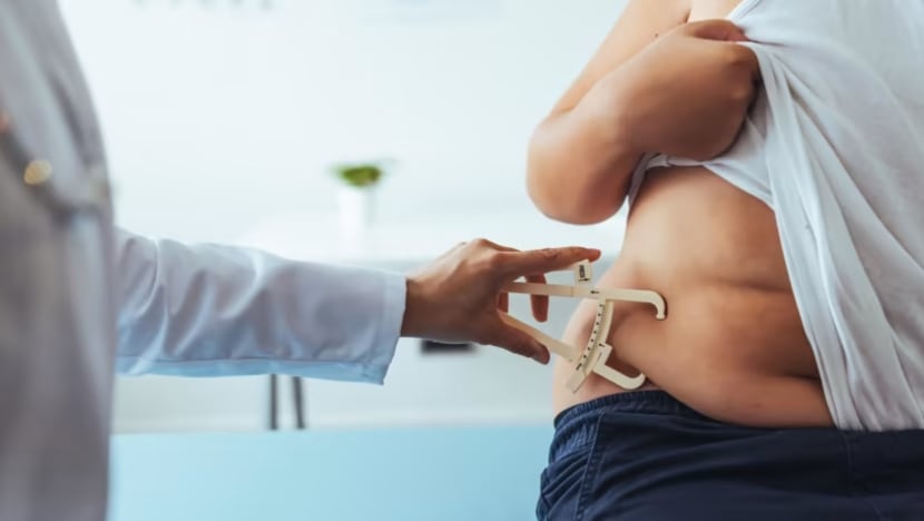 Obesiti dalam kalangan kanak-kanak makin meningkat; malukan mereka bukan huraian