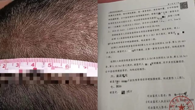 误认孙女遭霸凌 上海阿公砍伤六岁女童判无期