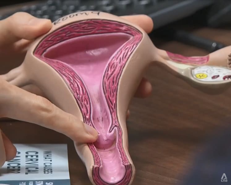 Screening, vaccination and help from men: How doctors believe cases of cervical cancer in women can drop