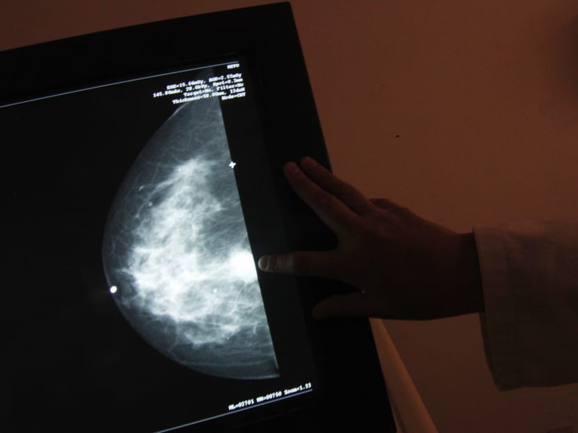 The take-up rate of breast-conserving surgery here lags behind the West as well as some parts of Asia.