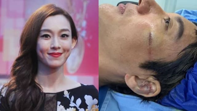 王力宏伤势惊人！范玮琪揭39针手术细节