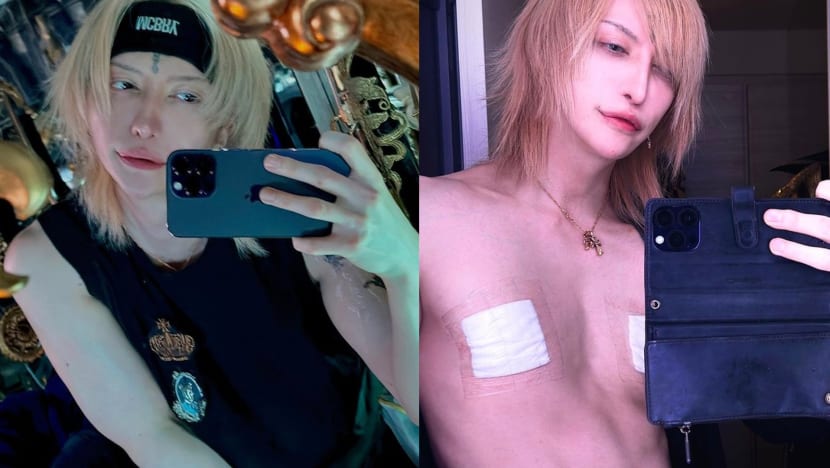 Japanese Guitarist Has Surgery To Remove His Nipples, Says “Men Don’t Need Them” Japanese Guitarist Has Surgery To Remove His Nipples, Says “Men Don’t Need Them”