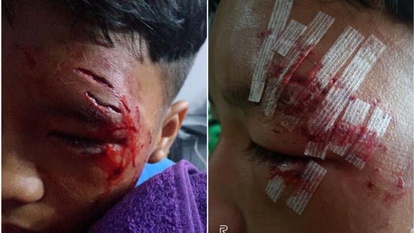 Kucing 'pendiam, pengecut' gigit budak hingga luka gara-gara kucing lain ekori tuannya