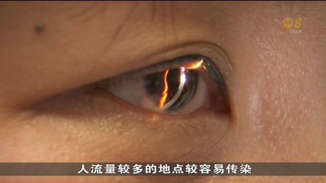 红眼症患者有增加趋势 医生：或与解除口罩令有关
