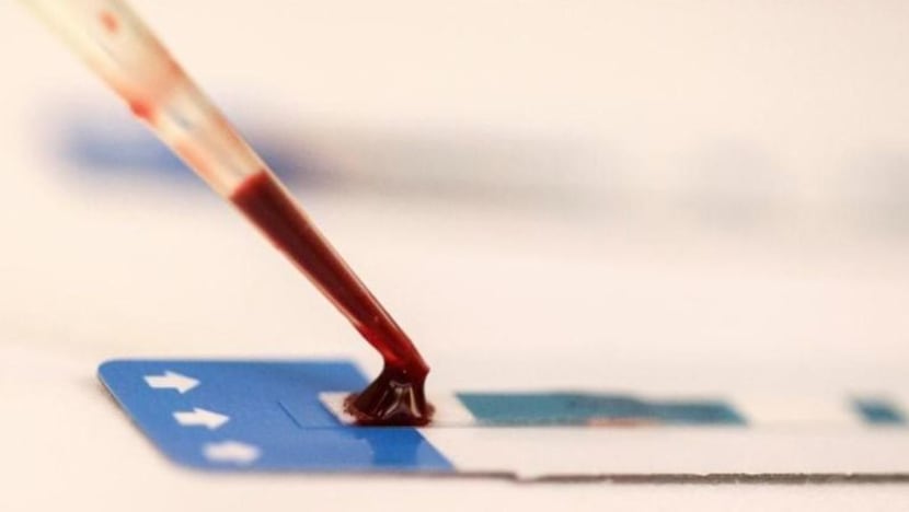 Lelaki tipu tentang sejarah hubungan seks sebelum derma darah dijangkiti HIV