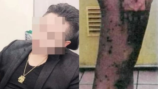 台少女遇“霸道总裁”性侵逼酒 还在腿上刺字成蜂窝