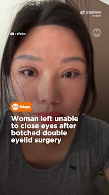 The surgeon was later found to have practised without a medical license. #8dayssg #8dayssgtrending #plasticsurgery #eyelids #surgeon 