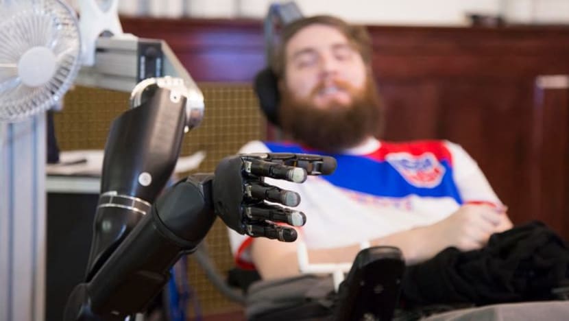 Lengan robot kawalan minda pulihkan deria sentuh Lengan robot kawalan minda pulihkan deria sentuh