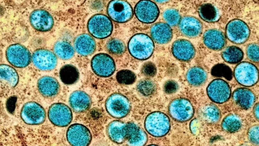 Mpox 'melecehkan' namun boleh dikawal, tidak perlu pakai pelitup buat masa ini: Ong Ye Kung Mpox 'melecehkan' namun boleh dikawal, tidak perlu pakai pelitup buat masa ini: Ong Ye Kung