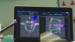 Related article image