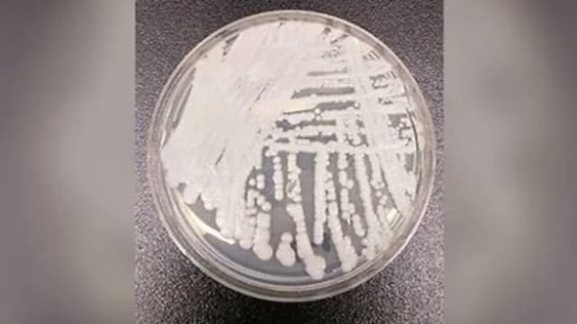 香港感染两超级病菌个案不断上升 当局试行AI对抗过度使用抗生素